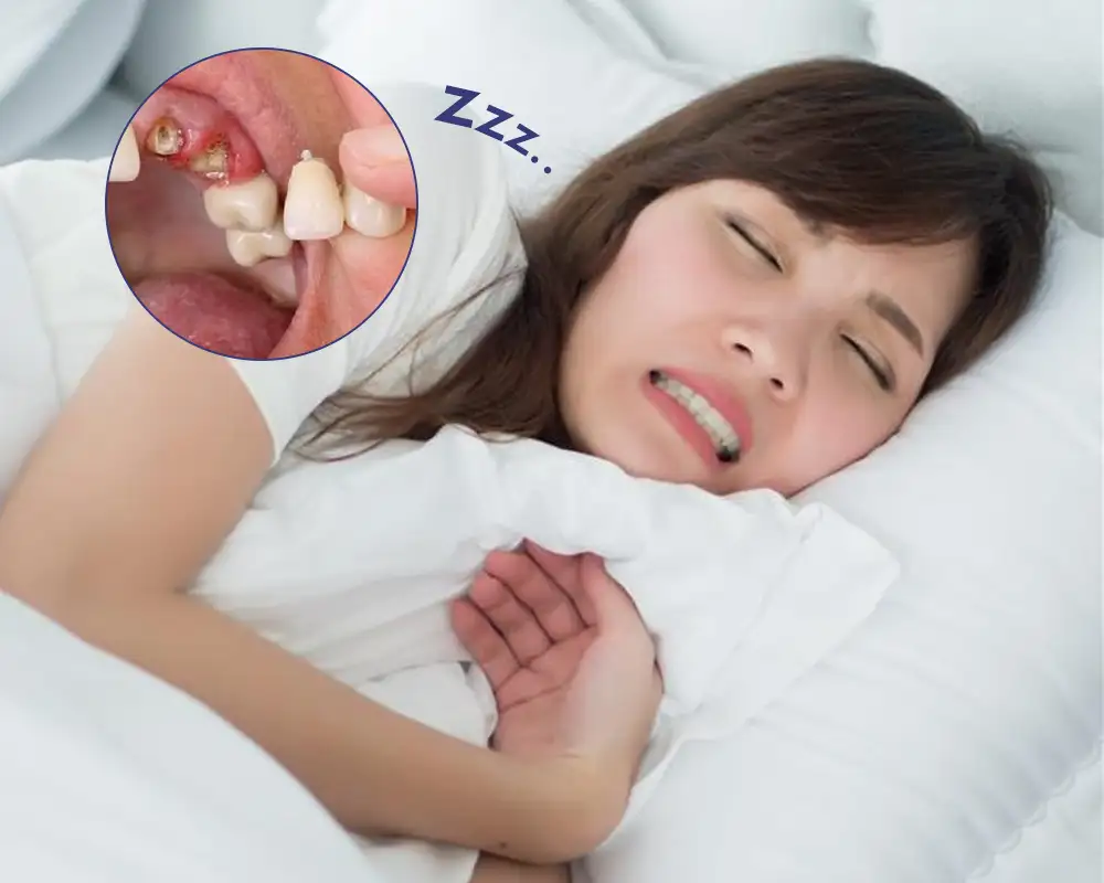 nằm mơ thấy rụng răng