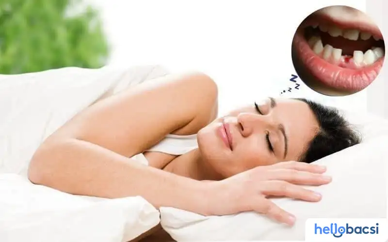 mơ bị rụng nhiều răng