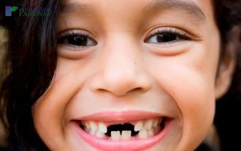 Giải Mã Giấc Mơ Thấy Răng Cửa Rụng: Điềm Lành Hay Dữ, Ý Nghĩa Sâu Sắc Và Con Số May Mắn