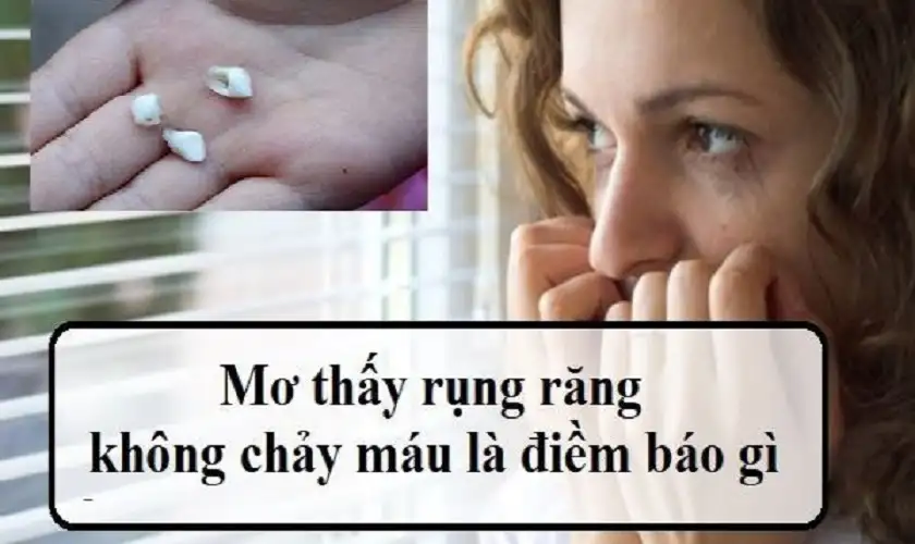 Chiêm Bao Thấy Răng: Giải Mã Điềm Báo, Ý Nghĩa Sâu Sắc & Con Số May Mắn