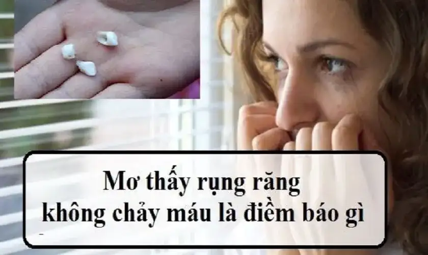 nằm mơ thấy rụng nhiều răng không chảy máu