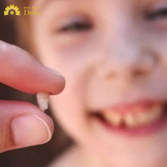 Giải Mã Giấc Mơ Thấy Rụng Rất Nhiều Răng: Điềm Báo Gì? Con Số May Mắn Nào?