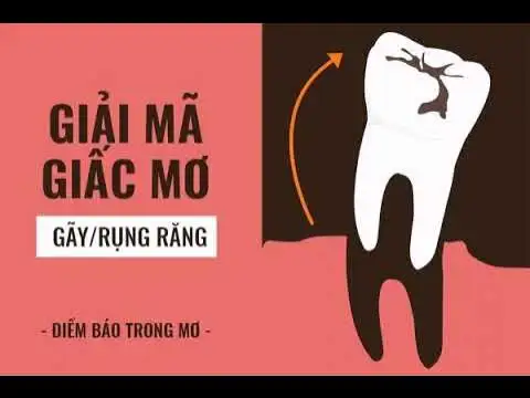 Giải Mã Giấc Mơ Rụng Răng Chảy Máu: Điềm Báo Lành Hay Dữ, Ý Nghĩa Sâu Sắc?