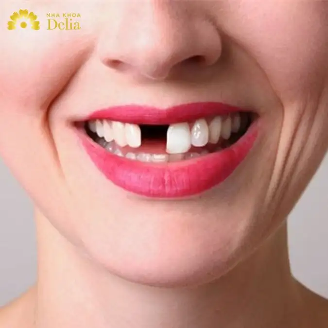 🦷 Giải Mã Giấc Mơ Rụng Răng: Điềm Báo & Con Số May Mắn ✨