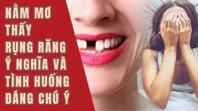 nằm mơ thấy rụng răng tốt hay xấu