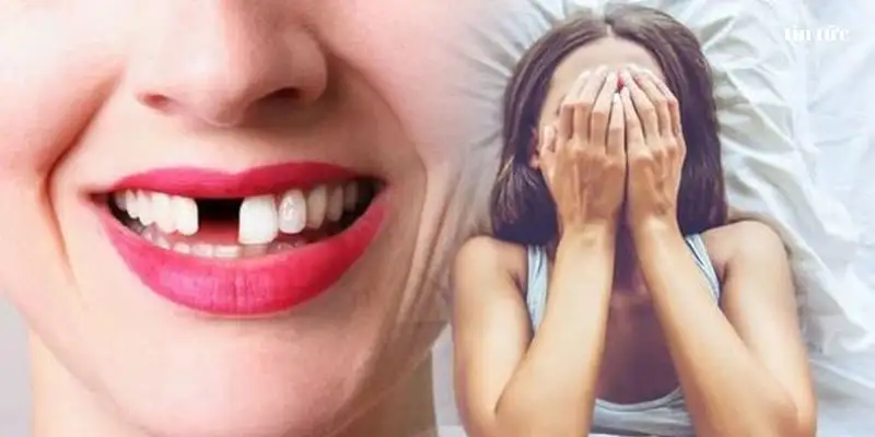 {giấc mơ thấy rụng răng}