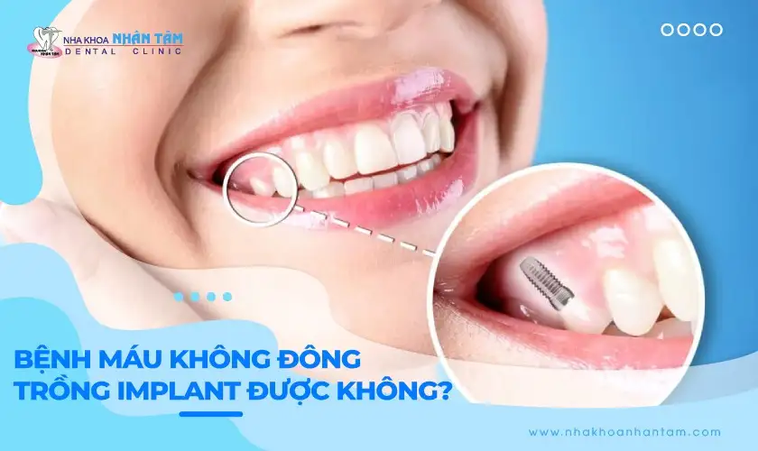 Giải Mã Giấc Mơ Rụng Răng Không Chảy Máu: Điềm Báo Tốt Hay Xấu?