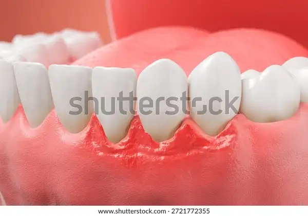 Nằm Mơ Thấy Hàm Răng Giả: Giải Mã Điềm Báo, Ý Nghĩa Ẩn Giấu & Con Số May Mắn