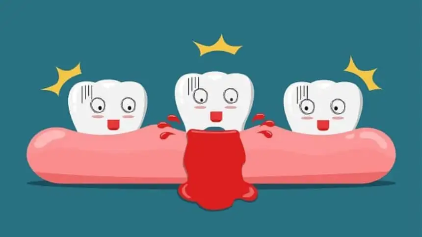 nằm mơ gãy răng chảy máu