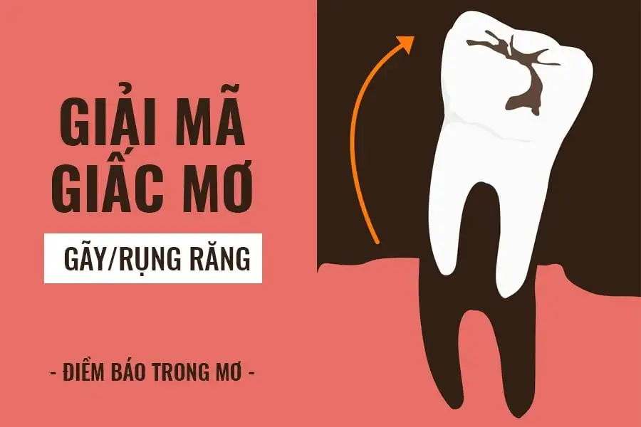 nằm mơ thấy mình bị gãy răng không chảy máu