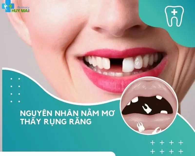 Giải Mã Giấc Mơ: Nằm Mơ Thấy Rụng 2 Răng Hàm Dưới Điềm Lành Hay Dữ?