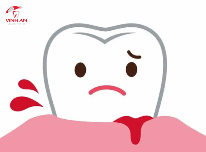 nằm mơ chảy máu răng