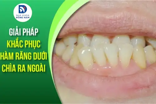 🌙 Giải mã giấc mơ thấy mơ gãy răng cửa hàm dưới: Điềm báo gì và nên làm gì? 🦷